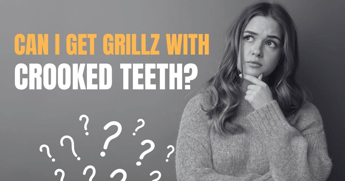 can-you-get-grillz-with-crooked-teeth-grillz-book