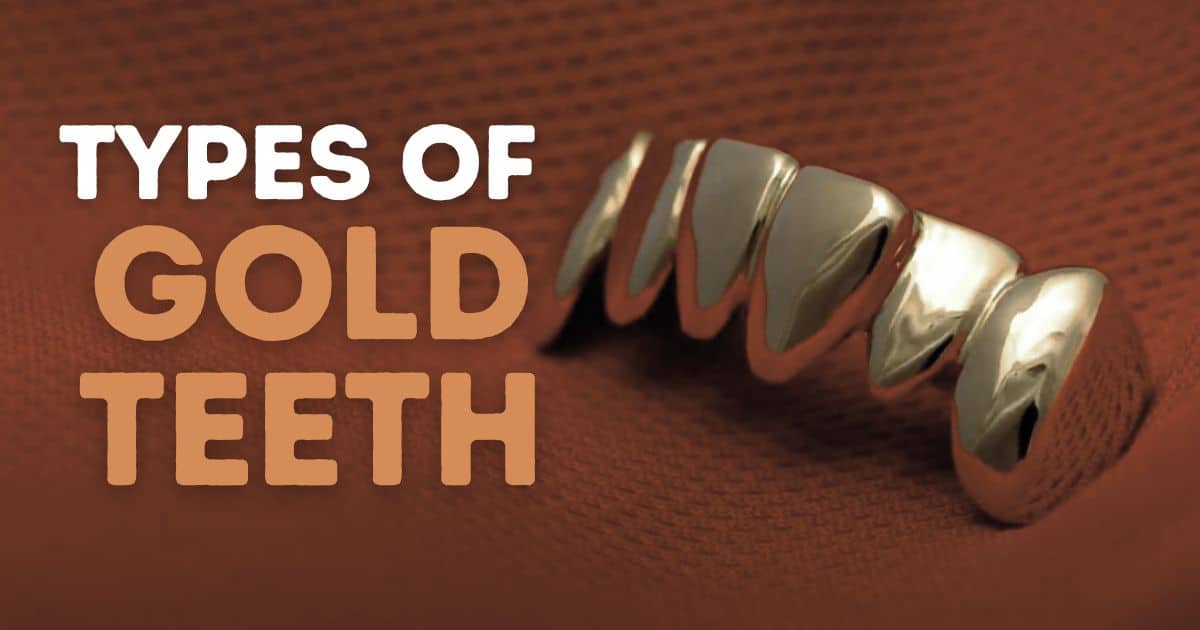 Types Of Gold Teeth