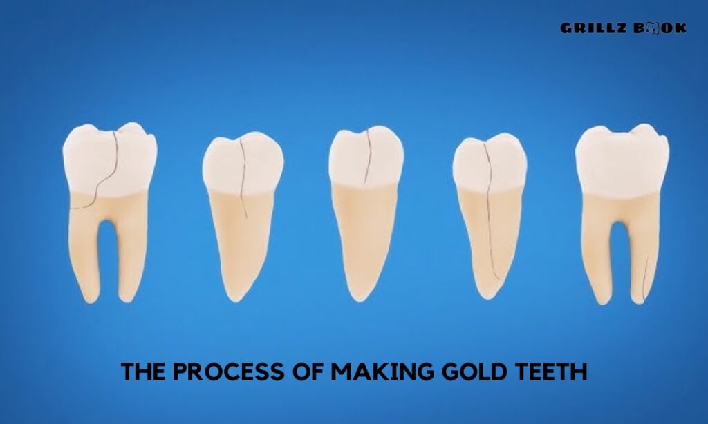 Beyonce Gold Teeth